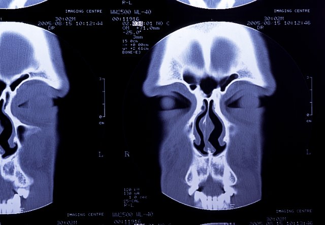 scary looking face in a ct scan