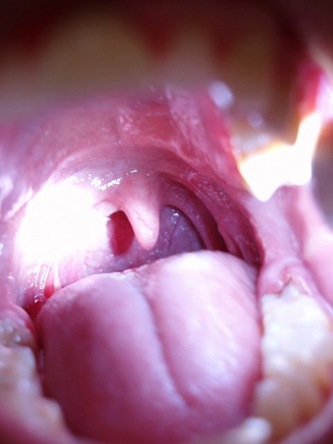 inside of a wide open mouth